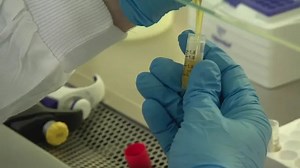 NHS to trial blood test that could detect over 50 cancers