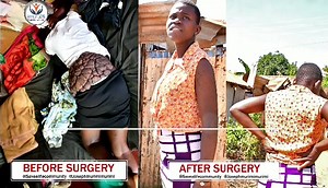 46 reactions · 3 comments | Save A Life Community, Transforming Lives! One life at a time,  Be reminded of our medical camp on 18th -23 rd February!!11 days to go. For more information please call us on 0722214817 #thesavealifecommunity #ServiceToHumanityIsServiceToGOD #charity #ServiceToHumanity #ServiceWithAHeart #TransformingLives | Dr. Joseph Murimi - Save a Life Community | Facebook