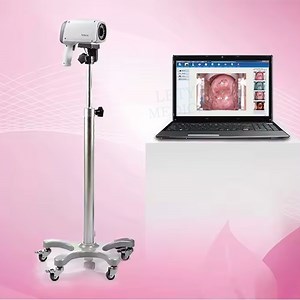 [Hot Item] Edan LED Digital Video Gynecological Colposcope