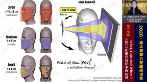 CBCT的工作原理和如何调试参数获取最佳影响质量