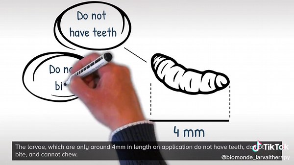 We think Larval Therapy is a wonderful thing.Take a look at our latest explainer video to learn more about the treatment and also BioMonde!#larvaltherapy #wound #woundcare #larvae #maggot #maggottherapy #healthcare #debridement #nhs #nurse #biosurgery