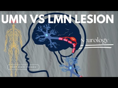 UMN v/s LMN lesions