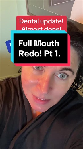 Then back into Invisalign for a bit. This has been since 2019! Long story. #maturewomenoftiktok #over50women #over60women #maturewomen #beautyatanyage #beforeandafter #skintransformations #antiaging #cosmeticdentistry #fullmouthrestoration #teethstory #fullmouthreconstruction #ilovemydentist