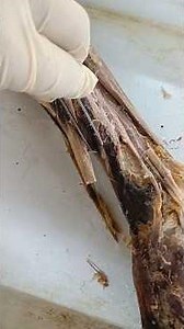 #shots #anatomy #dissection of forearm deep five muscles of extensor compartment.