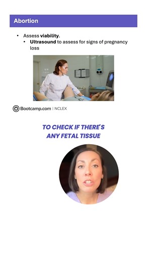 NCLEX Bootcamp on Instagram: "Comment "Crash Course" to get our high-yield full crash course video about Abortion, Cervical Insufficiency & IUFD. #NCLEX #nursingstudent #nursingschool"