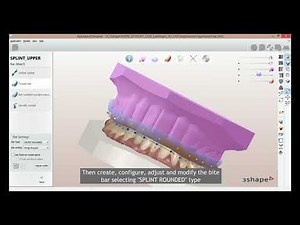 Bite Rising Splint Design in ‪@3shape‬