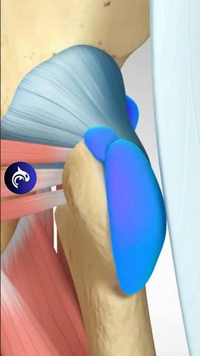 Learn about Hip Bursitis #hip #bursitis #orthopedicsurgeon