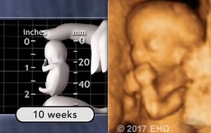 Pro-lifers release pregnancy guide app showing stunning footage of developing pre-born baby - LifeSite
