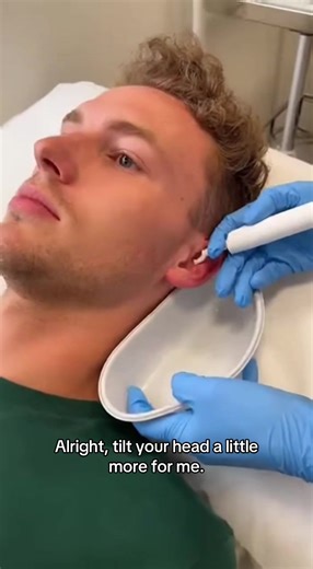 Effective Earwax Removal Techniques