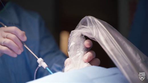 Mayo Clinic's approach to fetal surgery - Mayo Clinic