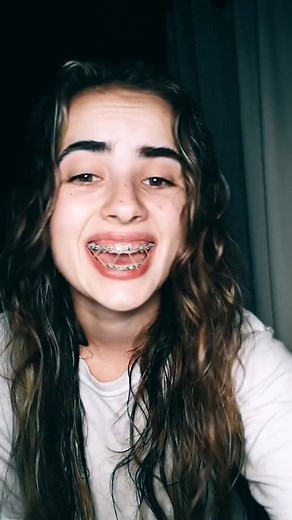 Understanding Rubber Bands on Braces: Pain, Eating, and Effectiveness Explained