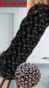 Severely Infected Hand Cleaning 😱 | Treatment Step by Step #viralvideoシfyp #treatmentviral #videos #infectionvideo #asmr | Md Lal Asmr