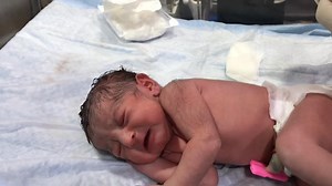 Newborn Umbilical Cord Care | Treatment & Cleaning Guide #NewbornCare #umbilicalcord #cutebaby #baby #adorablebaby Newborn Umbilical Cord Care | Treatment & Cleaning Guide #NewbornCare #UmbilicalCord 🍼 In this video, Dr. Sulaiman Shah explains the correct way to treat and care for a newborn’s umbilical cord. Proper cleaning and observation are crucial to prevent infection and ensure safe healing in the first few weeks of life. 👶 What you’ll learn in this video: How to clean the umbilical cord 