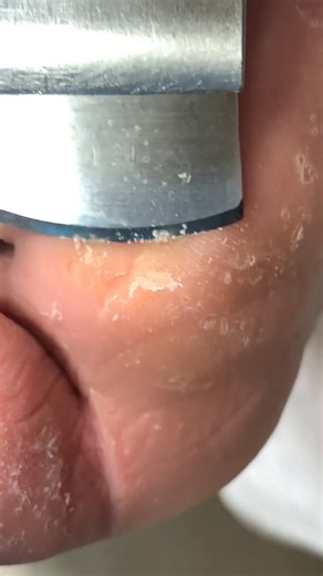 273K views · 743 reactions | Foot scraping dead skin #pedicure | Nail Salon | Facebook