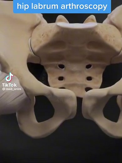 hip labrum arthroscopy by @med_anim #labrum #hip #arthroscopy #surgery