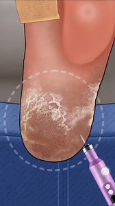 Immersive Foot Treatment #stopmotion #foot #immersive | Meng's Stop Motion