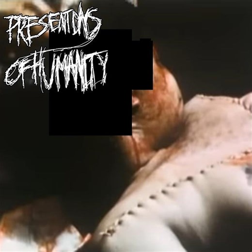 Ripped Apart From The Torso By a Maniac Monster
