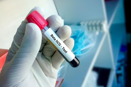 Beta hCG - normy badania. Jak odczytać wyniki?