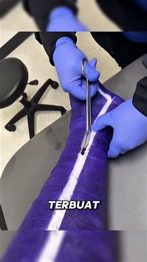 inilah alasan Jangan pernah memakai gips model lama seperti ini lagi. #shorts #sehar