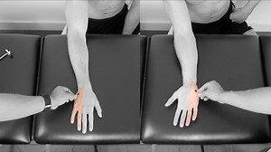 Dermatomes Upper Limb | Peripheral Neurological Examination