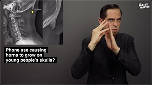 56K views · 1.1K reactions | Phone use causing horns to grow on young people’s skulls? | The Daily Moth | Facebook