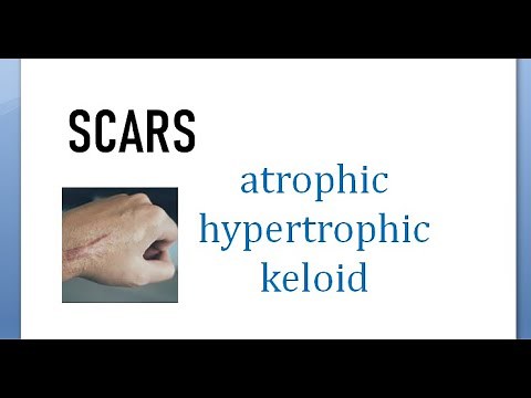 Surgery 015 Scars Atrophic hypertrophic keloid difference compare between vs wound