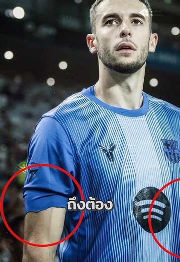 เรื่องราวของโกลบาร์ซ่ากับการตัดแขนเสื้อ