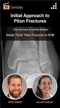 Initial Approach to Pilon Fractures