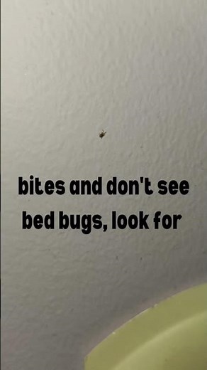 Bird Mites can Bite - (they tend to be more active at night)