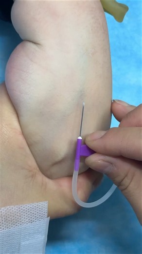 Nursing Skills: How to Give IV Inyección Safely | Intravenous Clinical Skills | IV & IM Inyección(2)