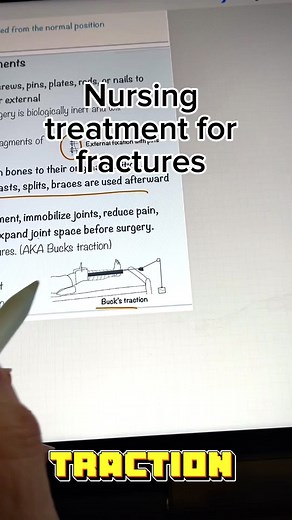 Nursing Treatments for Fractures and Traction Types