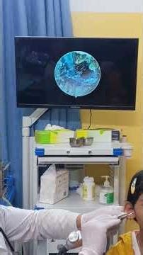 Close-Up Look Inside Ear Endoscopy 👂🩺 #EarExam #EarCare #ASMR