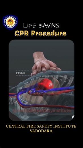 Central Fire Safety Institute | CPR Pro 🧑‍⚕️🧑‍🚒🏥⛑️🩺💉🚑🚒 #cfsi #education #cpr #training #firefighter | Instagram