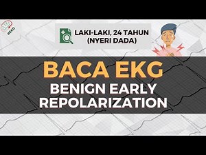 BACA EKG (BENIGN EARLY REPOLARIZATION) | EP.2