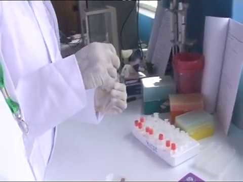 DNA extraction from dry blood spot DBS Practical 1 Dr Fowora