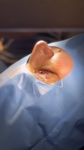 Cornea Reshaping Process Explained