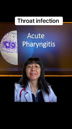 Understanding Acute Pharyngitis: Causes and Treatment