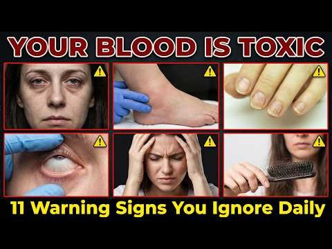 Your Blood Is Toxic. 11 Warning Signs You Ignore Daily.