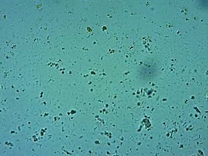 trichomonas intestinalis