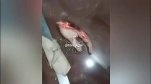 DAMN! THEY CUT OFF HIS HAND FOR NOT PAYING MONEY THAT HE OWED