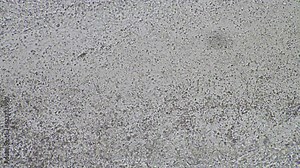 Sperm under the microscope. Looking a semen swimming. Healthy fertile man high sperm count