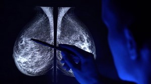 Doctor Pan Checking Mammogram X-ray Mammography Stock Footage Video (100% Royalty-free) 1033135925 | Shutterstock