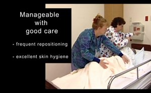 The Integumentary System: Objective Data, Pressure Ulcers