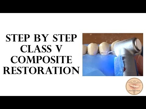 STEP BY STEP - Class V dental restoration with composite