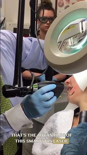 SmartSkin CO2 Laser: Pain-Free Results