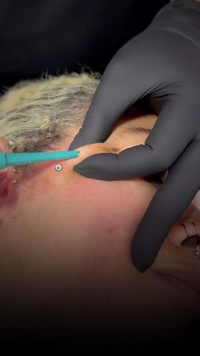 9.3K views · 2K reactions | • Face dermal piercing • You can BOOK ONLINE NOW! ▾ Link in bio! ▾ @undergroundtattoos ⠀ Walk-ins available Cash only It’s not a Piercing unless it’s Underground! ⠀ #dermalpiercing #dermalanchor #piercings #piercing #earpiercings #earpiercing #earpiercingideas #earpierced #londonpiercer #londonpiercing #piercingideas #watford #londontattoostudio | Underground Tattoos Watford | Facebook