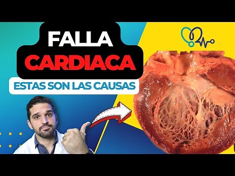 HEART FAILURE: its causes and diagnosis. 🩺✅