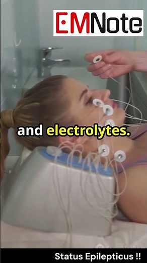 Status Epilepticus #medical #nursing #doctor