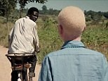 Tanzania's albinos limbs sell for $75,000 (related)