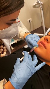 Conosci la tecnica Russian Lips? In questo video la Dott.ssa Giada Ascoli spiega di cosa si tratta: è molto usata nell'ambito dei Filler Labbra per avere labbra alte e piatte e un Arco di Cupido molto accentuato. 👄 Questo mese il Filler Labbra è in promo a soli 199€ anziché 280€, prenota adesso un consulto gratuito nel centro Clinic più vicino a te! 👨‍⚕🧑‍⚕ | Clinic Medical Beauty